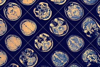 A grid of images showing different cross sections of a human brain MRI. A grid of images showing different cross sections of a human brain MRI.